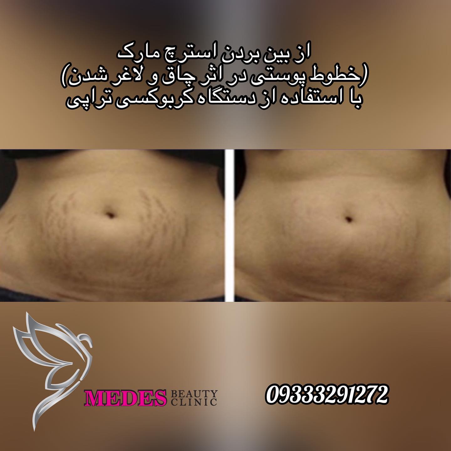 گالری کربوکسی تراپی